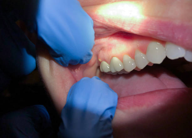 Best Walk-In Emergency Dentist in Temple, PA
